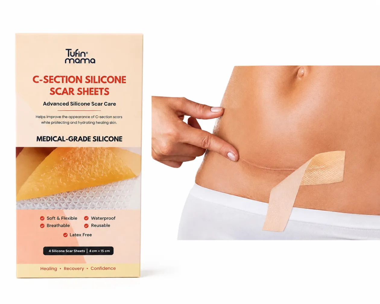 C-Section Silicone Scar Sheets (4 Pieces)